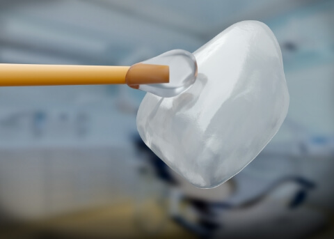 Close up of adhesive being applied to a dental veneer