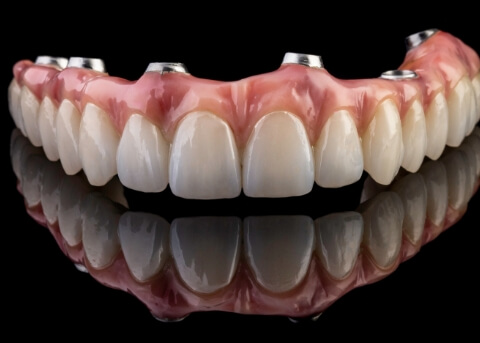 Implant denture against black background