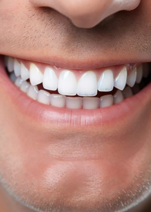 Close-up of man’s smile with healthy teeth and gums