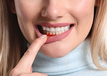 You may need scaling and root planing if you are showing signs of gum disease