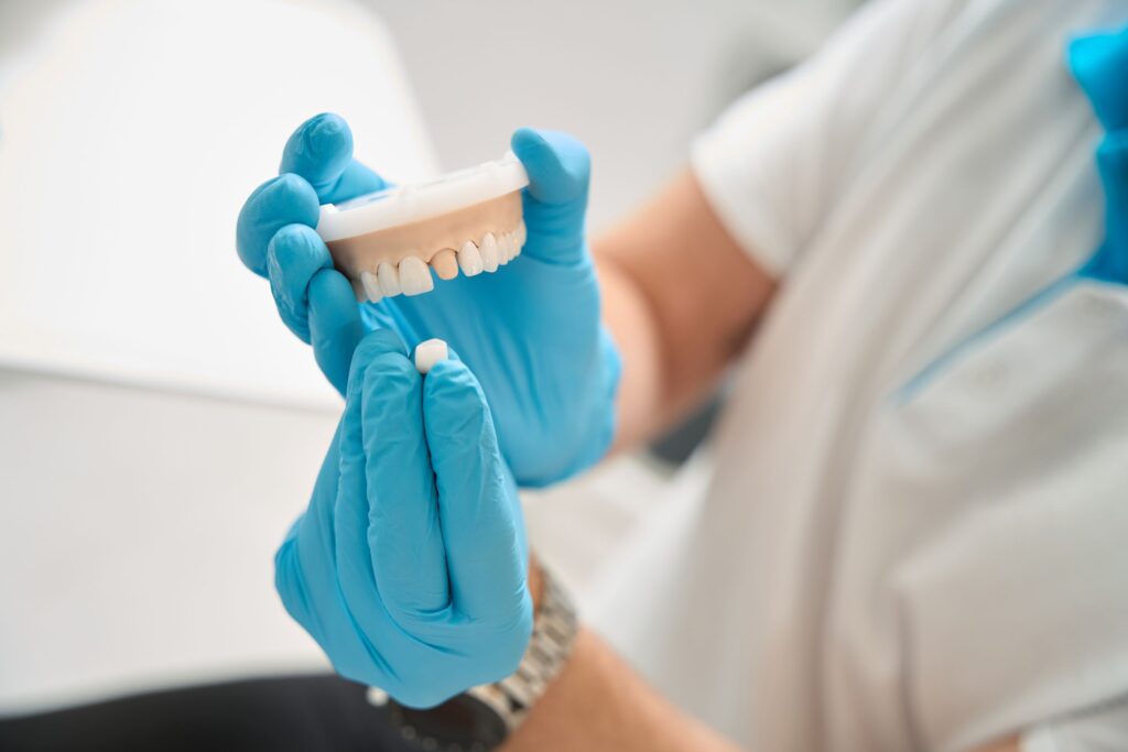 Dentist in blue gloves placing sample dental crown over model abutment tooth