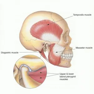 Illustration depicting facial muscles associated with the jawbone